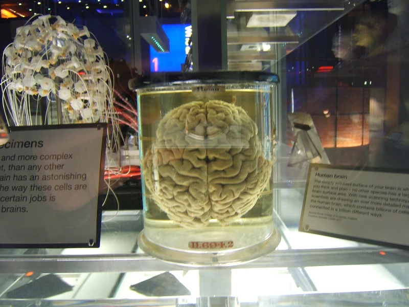 Brain museum 